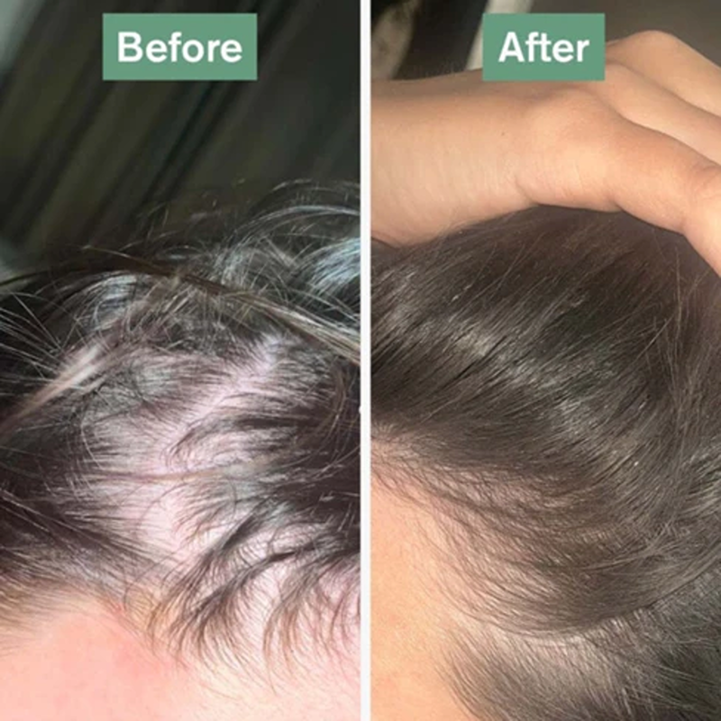 Dr Vegan Hair Saviour