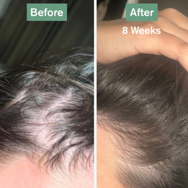 Dr Vegan Hair Saviour