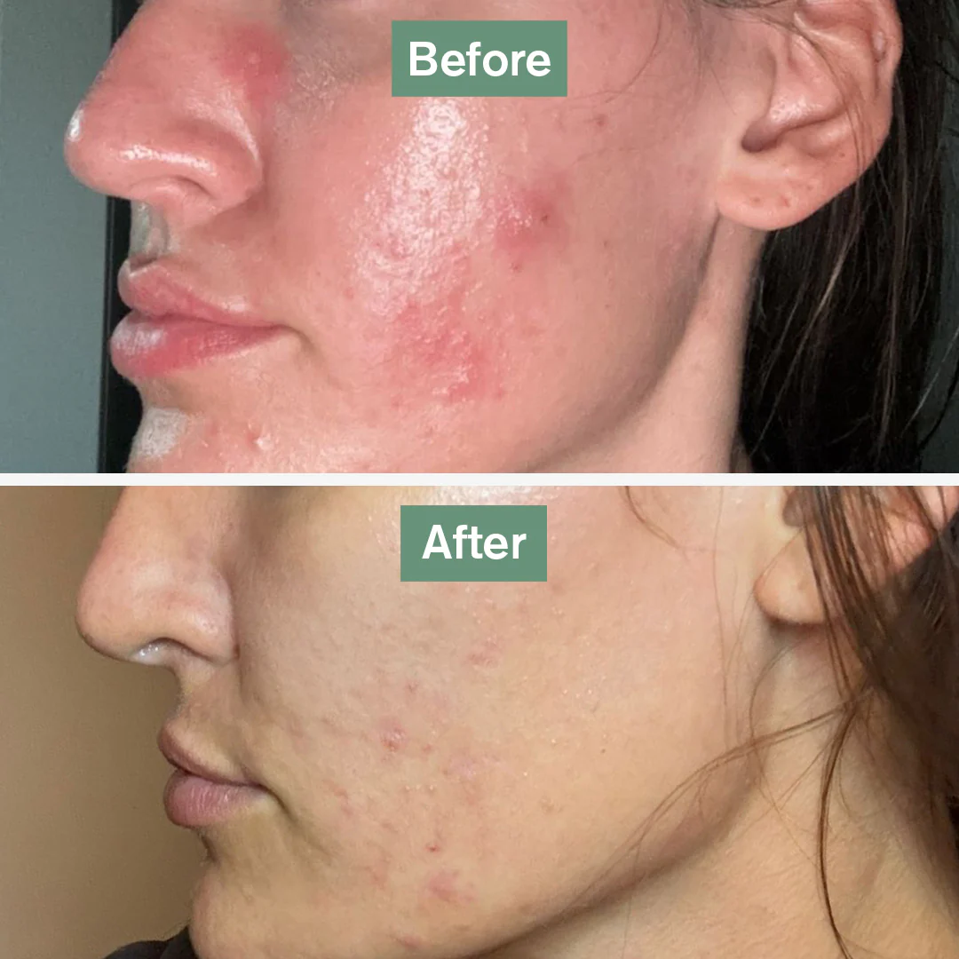 Dr.Vegan skin saviour